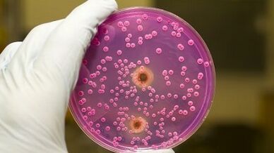 Heyecanlandığında erkeklerde patolojik akıntı